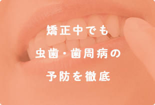 矯正中でも虫歯・歯周病の予防を徹底