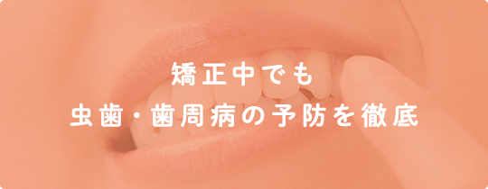 矯正中でも虫歯・歯周病の予防を徹底
